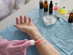 Alergologiczne testy-skórne na przedramieniu