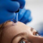 Realizacja zabiegu mezoterapii mikroigłowej