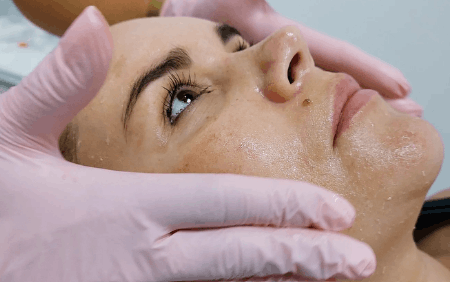 Realizacja zabiegu sesderma ferulac c peel
