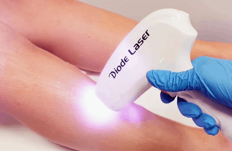 Urządzenie do depilacji laserowej