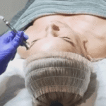 Wykonanie zabiegu dermaoxy