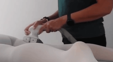 Wykonanie zabiegu eneromologii